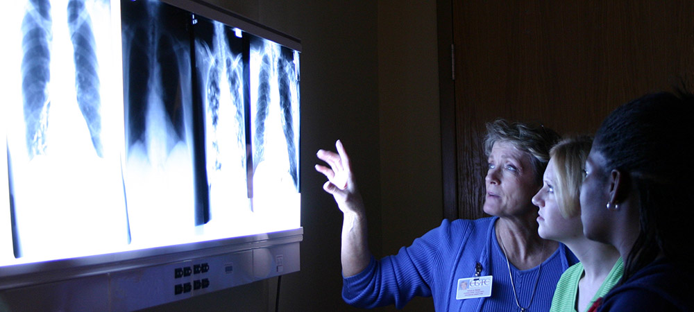 Radiologic Technology students looking at x-rays.